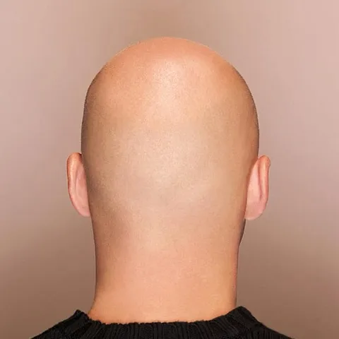 PickleBald 👩‍🦲